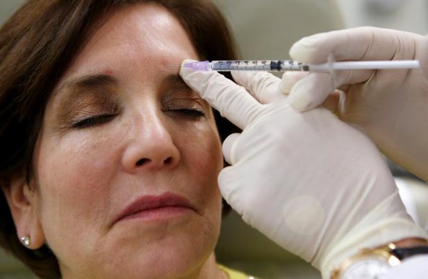 Botox: mehr als ein Antifaltenmittel