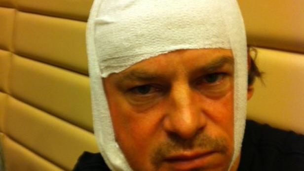 Ein Mann mit einem Verband um den Kopf.
