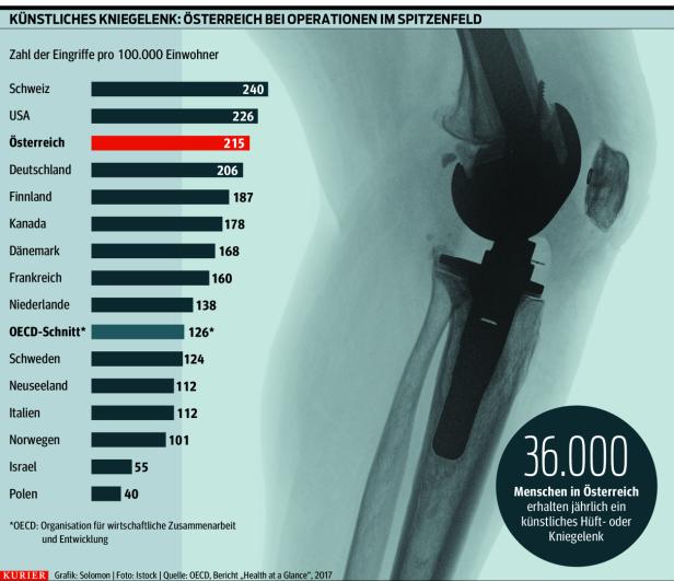 Neues Kniegelenk: Wird in Österreich zu häufig operiert?