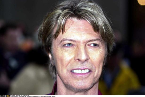 Warum David Bowie zwei unterschiedliche Augenfarben hatte