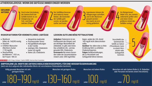 Der neue Blick aufs Cholesterin