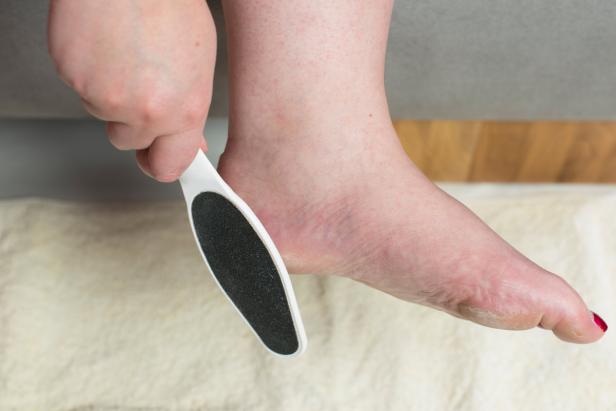 Eine Person entfernt Hornhaut mit einer Hornhautfeile vom Fuß.