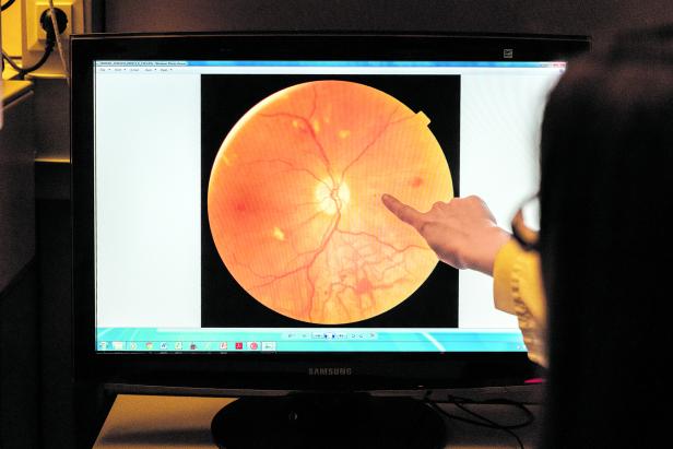 Universitätsklinik für Augenheilkunde und Optometrie