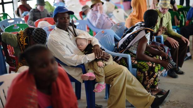 Wo Menschen mit Albinismus vor Verfolgung geschützt sind