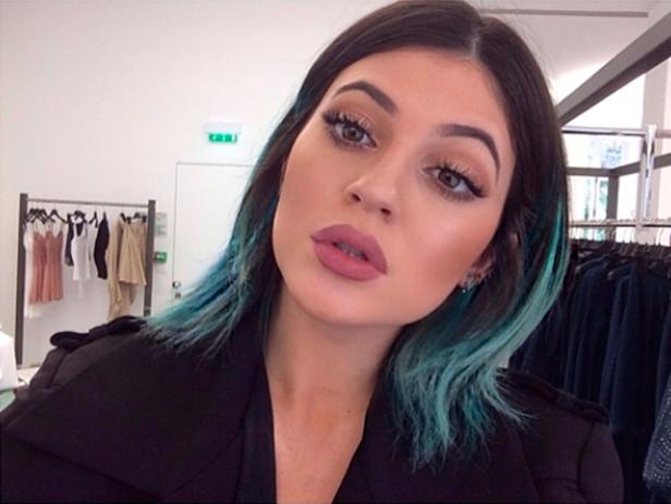 Kylie Jenner: Beauty-OPs oder nicht?