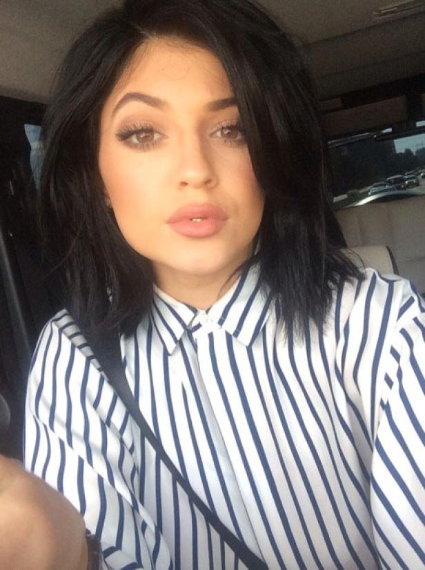 Kylie Jenner: Beauty-OPs oder nicht?
