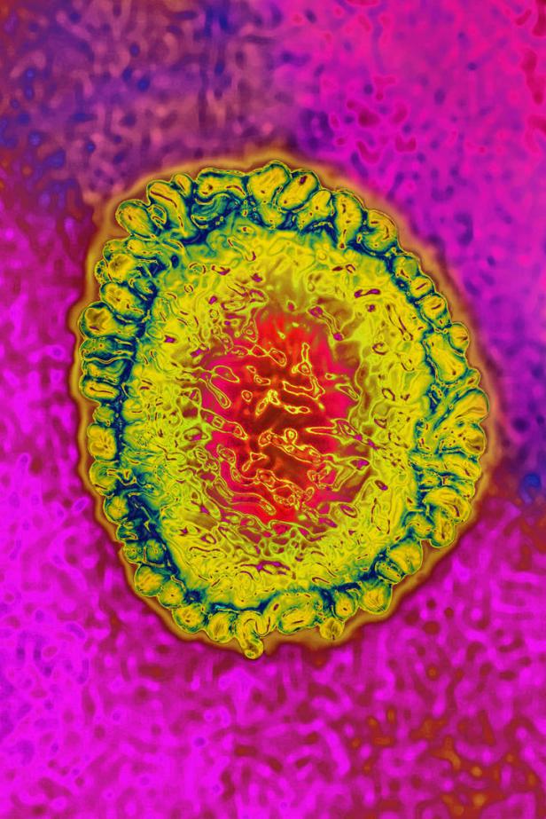 Coronavirus: Was man bis jetzt über den neuen Erreger weiß