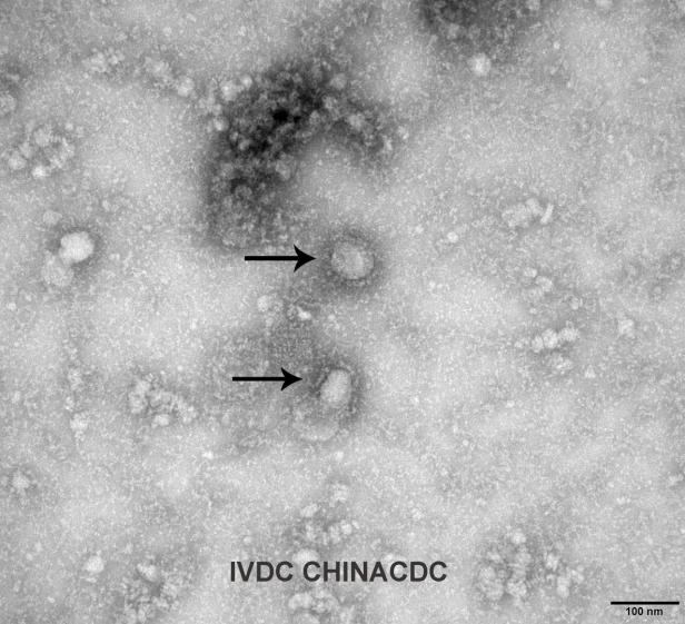 Zähe Coronaviren: Bis zu neun Tage auf Oberflächen haltbar
