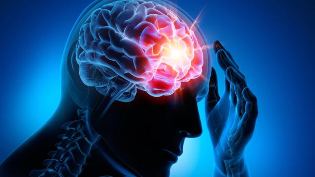 Eine schematische Darstellung eines Kopfes mit hervorgehobenem, schmerzendem Gehirn.