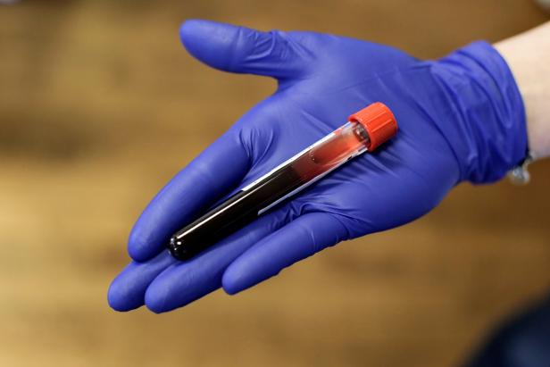 A phlebotomist holds freshly donated blood at the Shoreline Masonic Lodge in Shoreline