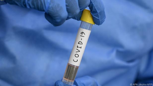 Geheilter Covid-19-Patient spendete Blutplasma.