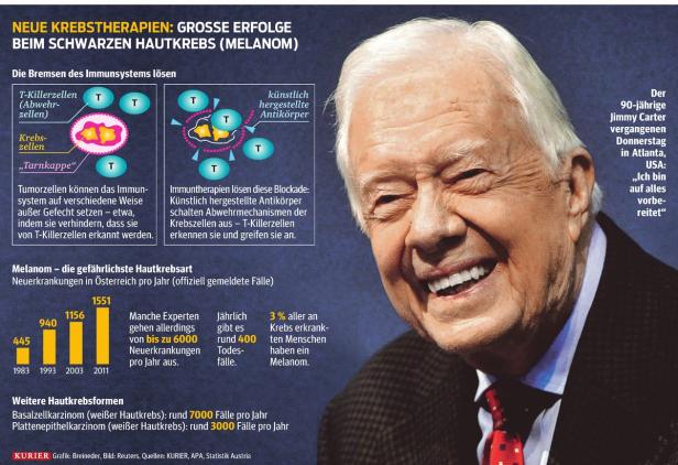 Trotz Metastasen: Gute Chancen für Jimmy Carter