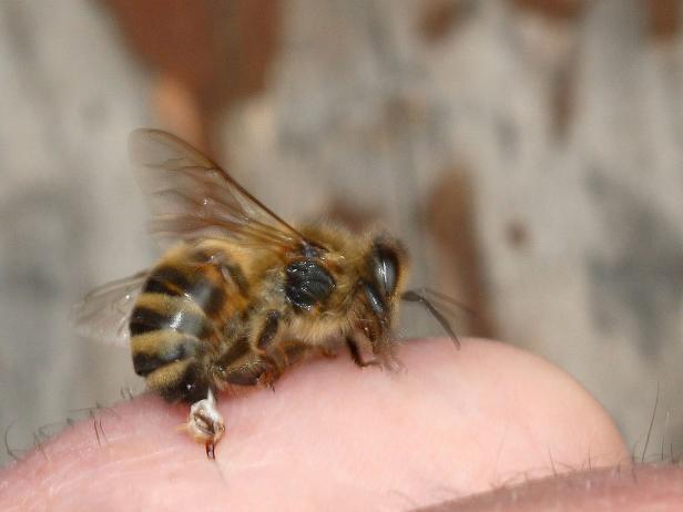 Von Hautwunden bis Krebs: Die Heilkraft der Bienen