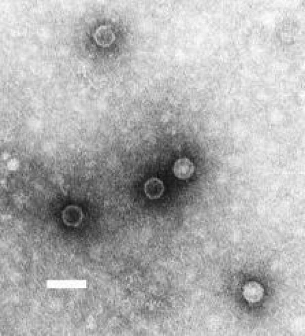Mutiertes Kinderlähmungs-Virus: Was Sie darüber wissen sollten