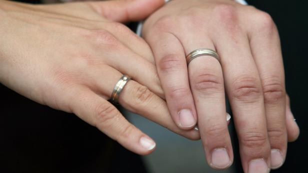 Zwei Hände mit Eheringen liegen aufeinander.