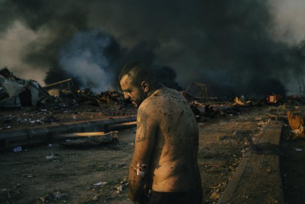Corona, Konflikte, Explosionen: Nominierungen für "World Press Photo"