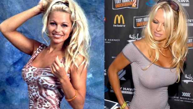 Die teuersten Brust-Implantate Hollywoods