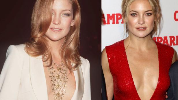 Die teuersten Brust-Implantate Hollywoods