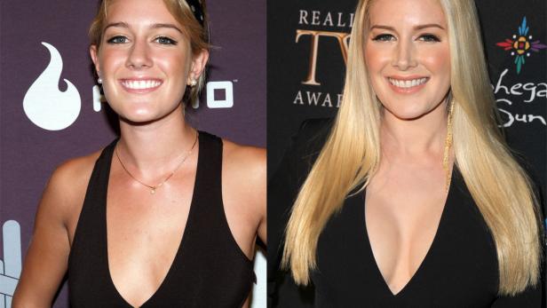 Die teuersten Brust-Implantate Hollywoods