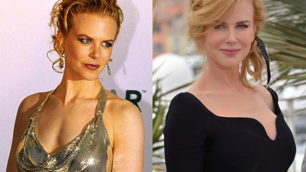 Die teuersten Brust-Implantate Hollywoods