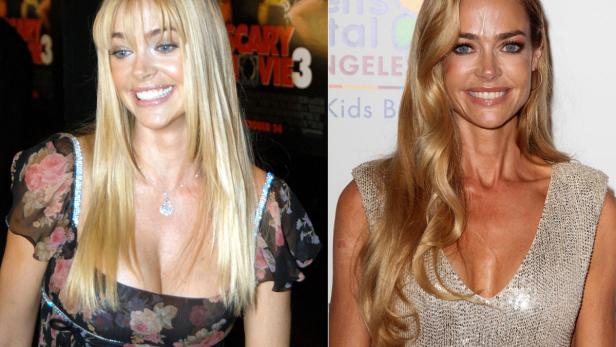 Die teuersten Brust-Implantate Hollywoods