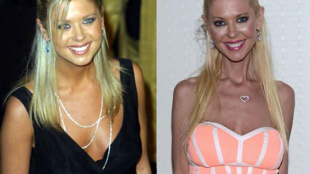 Die teuersten Brust-Implantate Hollywoods