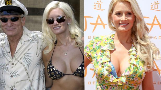 Die teuersten Brust-Implantate Hollywoods