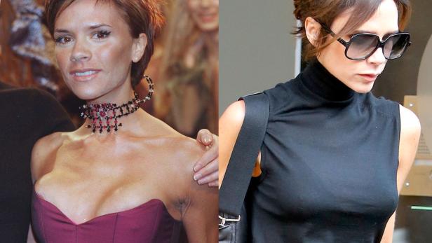 Die teuersten Brust-Implantate Hollywoods