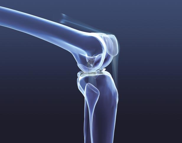 Die modernsten Behandlungen bei Knieverletzungen