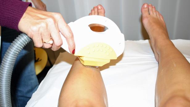 Eine Frau führt eine Laser-Haarentfernung an einem Bein durch.