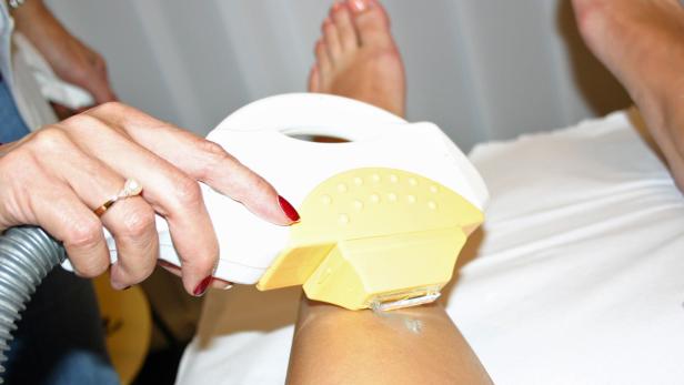 Eine Frau unterzieht sich einer Laser-Haarentfernung am Bein.