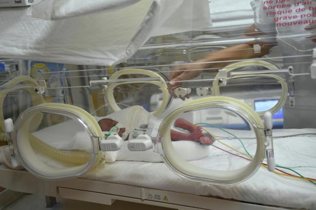 Neunlinge geboren: 35 Ärzte anwesend, Babys wohlauf