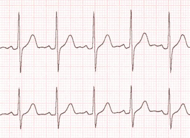 Narkose bis Klonschaf: Die Meilensteine der Medizin