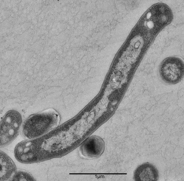 Narkose bis Klonschaf: Die Meilensteine der Medizin