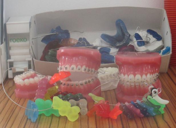 Zahnmodelle mit Zahnspangen und farbigen Gummibändern stehen auf einem Tisch.