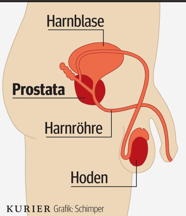 Eine schematische Darstellung der männlichen Harnwege mit Harnblase, Prostata, Harnröhre und Hoden.