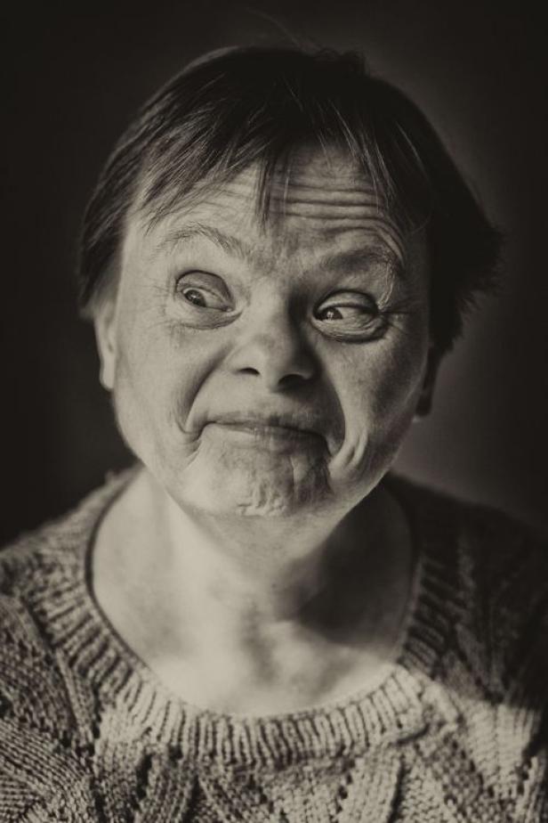 Das Porträt einer Frau mit Down-Syndrom, die eine Grimasse zieht.