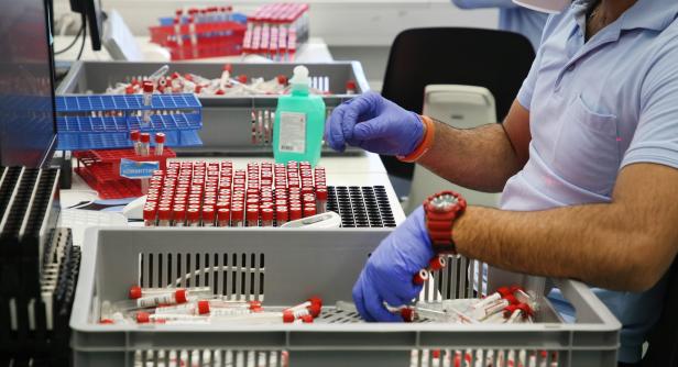 Alles gurgelt: Das Millionengeschäft mit den PCR-Tests