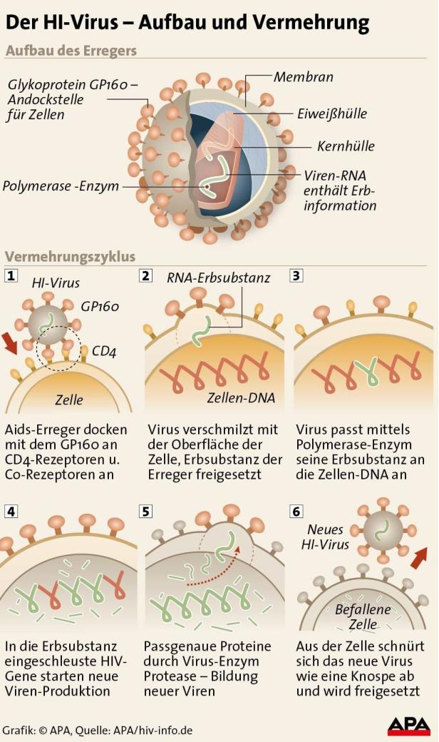 Wienerin durch Blutkonserve mit HIV angesteckt
