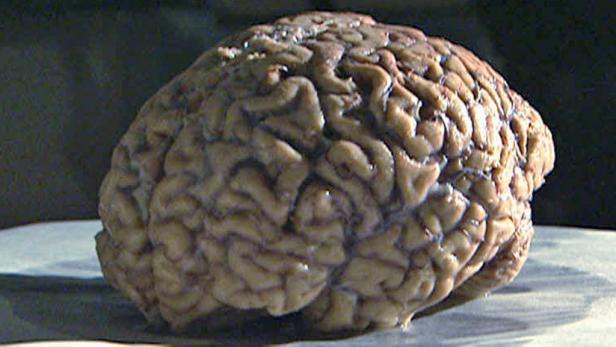 Ein menschliches Gehirn liegt auf einer hellen Oberfläche.