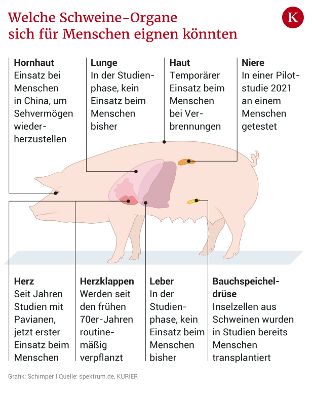 Medizin-Sensation mit Schweineherz: Wenn Tierorgane Menschenleben retten