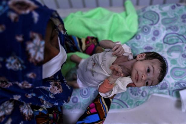 Hunger in Afghanistan: Ein Mädchen für 840, eine Niere für 1.200 Euro