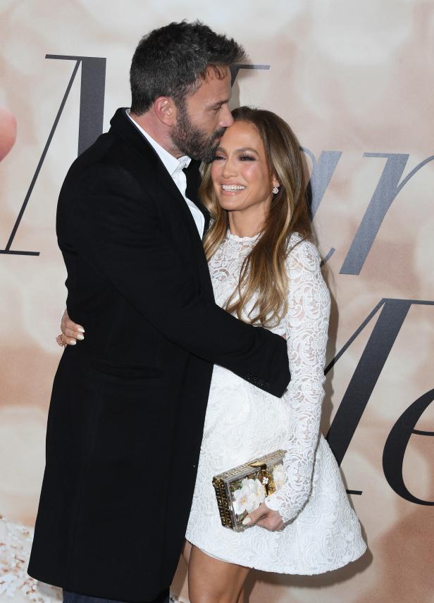 Ben Affleck küsst Jennifer Lopez auf die Stirn.