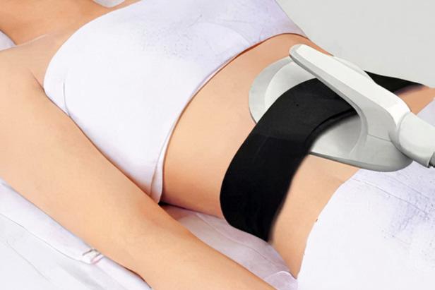 Eine Frau erhält eine nicht-invasive Behandlung zur Fettreduktion am Bauch.