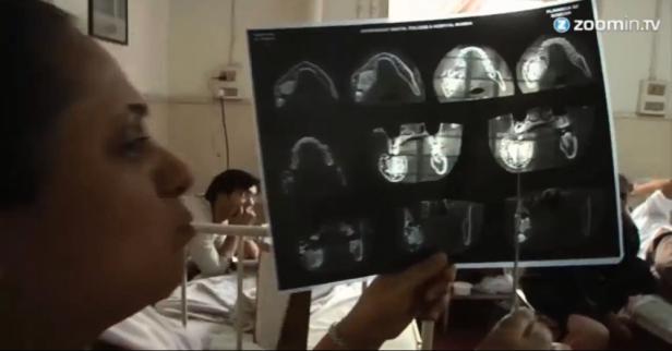 Bandwurm im Gehirn: Student beinahe gestorben