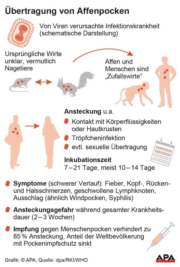 Erster Fall von Affenpocken in Österreich: "Patient ist guter Dinge"