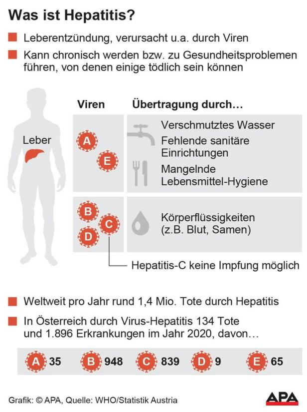 650 Fälle mysteriöser Hepatitis bei Kindern: Welche Spuren es gibt
