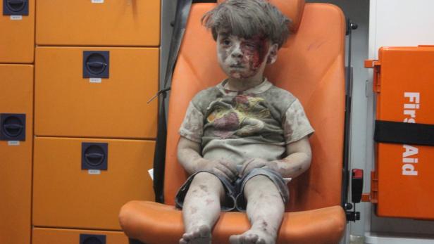 Bruder des syrischen Buben Omran gestorben