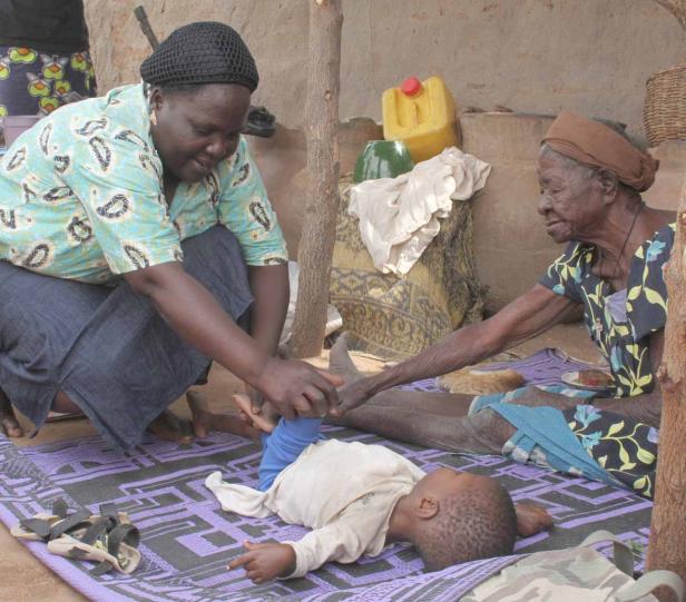 Eine Frau behandelt das Bein eines Babys, während eine ältere Frau zusieht.