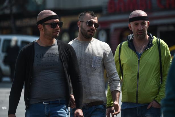 Patienten nach einer Haartransplantation in Istanbul am Taksim-Platz.